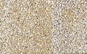 [4] muschelkalk